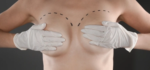 Breast Reduction